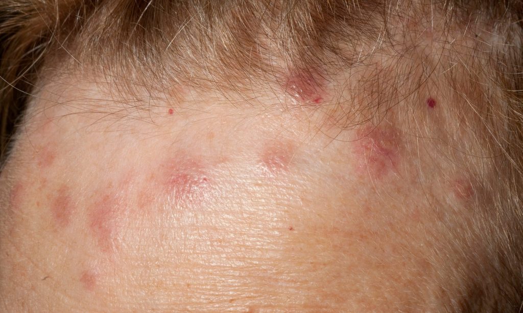 SB. These are the signs that it is cre…See more