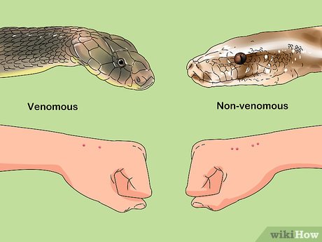 Snake Bite First Aid: Symptoms, Treatment, and What Not to Do